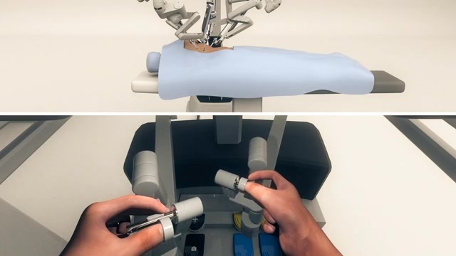 Robotic Lobectomy Procedure -- Medical & Surgical animation
